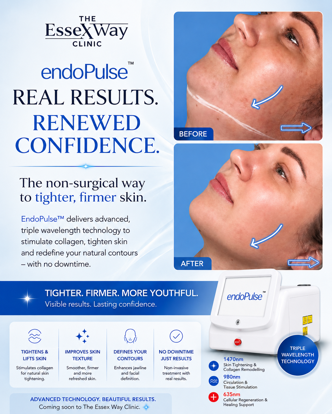 EndoPulse real results — before and after with treatment benefits